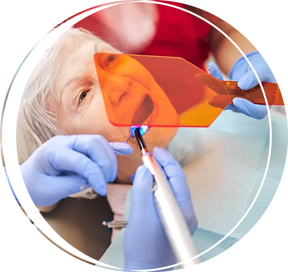 Composite Fillings In Carlsbad, CA