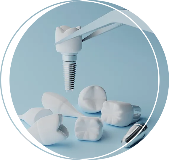 Dental Crowns In Carlsbad, CA