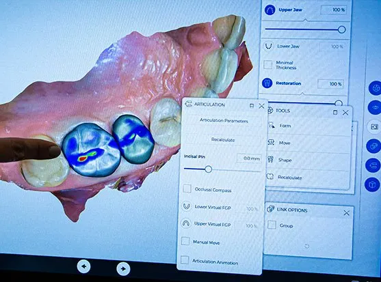 Dental Exams In Carlsbad, CA