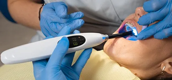 Dental Sealants In Carlsbad, CA