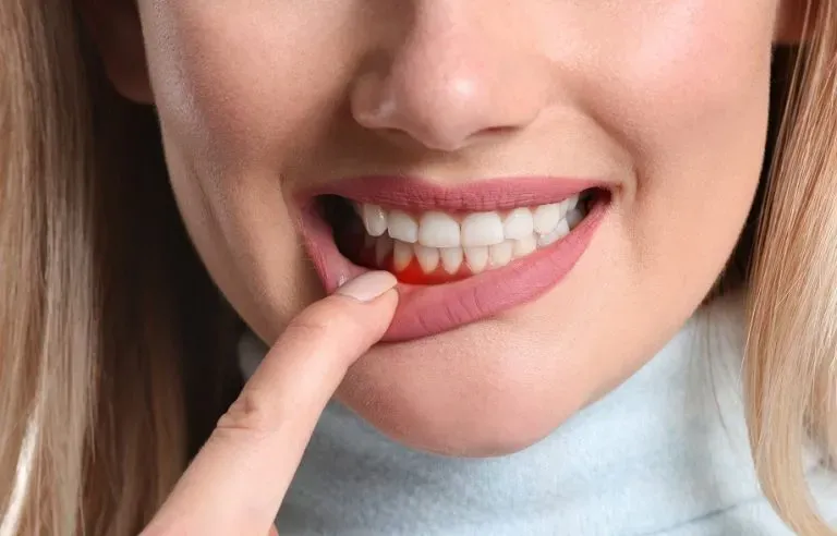 Gum Disease Treatment Near Carlsbad