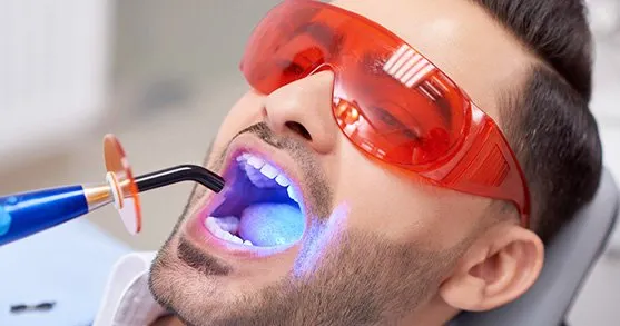 Teeth Whitening Near Carlsbad, CA