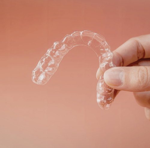 Clear Aligners in Carlsbad CA