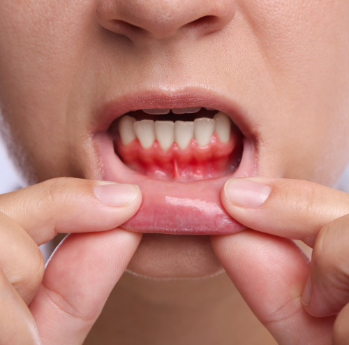 Periodontal Dentistry