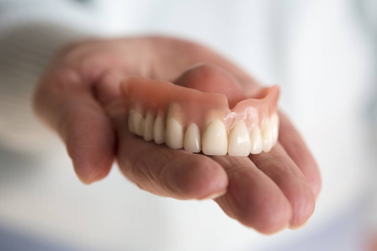 Considering dental implants versus full dentures