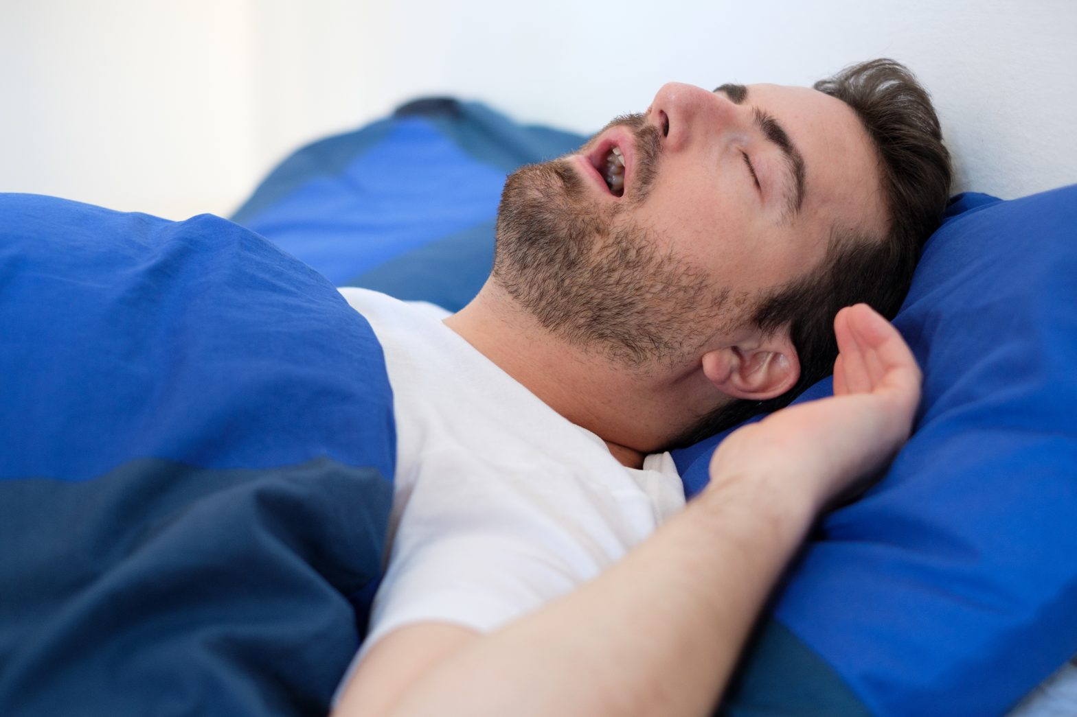 Sleep Apnea Treatment in Carlsbad